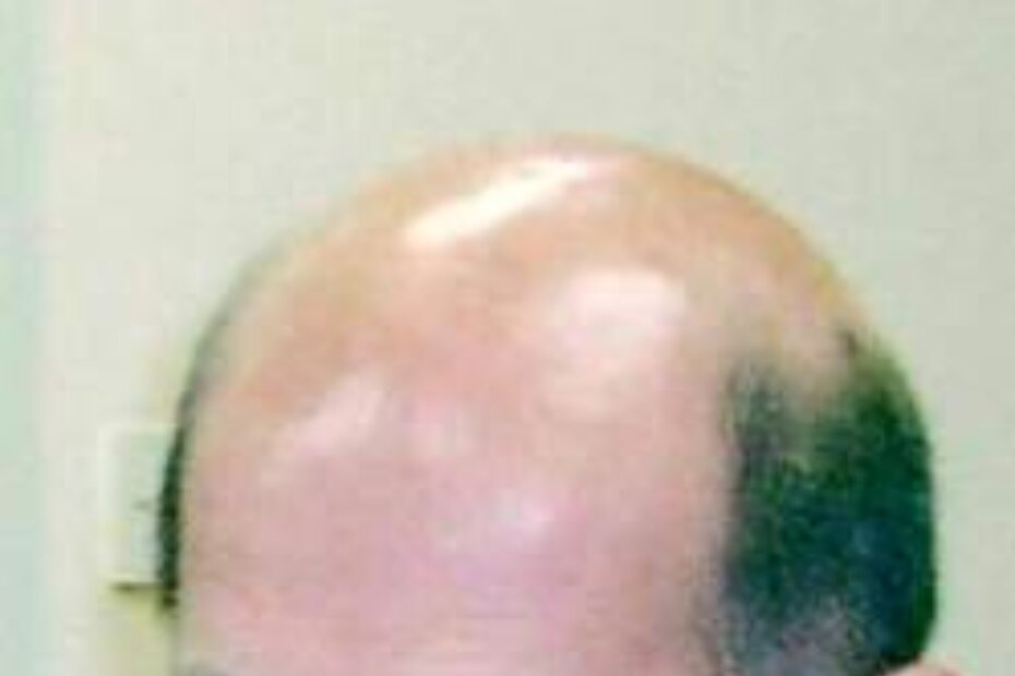 Načelnik Marino Baldini