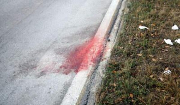 Teško ozlijeđen vozač skutera