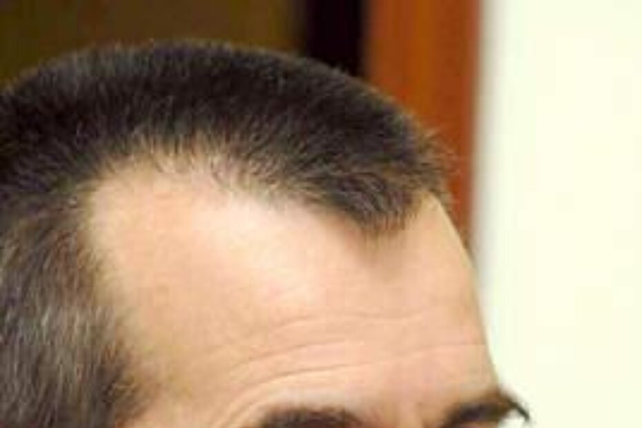 Dario Baldaš