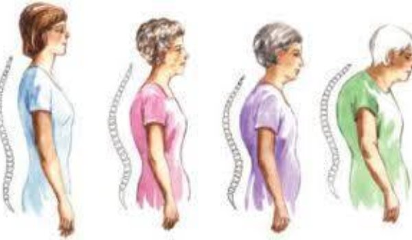 Predavanje u Galiji: Kako liječiti osteoporozu i osteoartritis