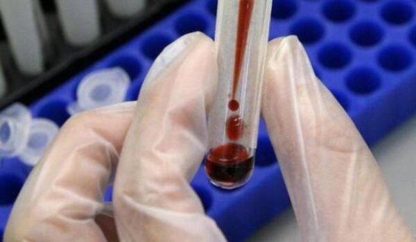 Ovaj tjedan anonimno testiranje na HIV