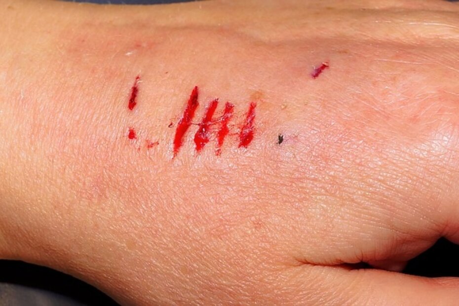 Foto: Ilustracija (Pixabay)