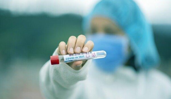 Hrvatska: 486 novih slučajeva u protekla 24 sata, u bolnicama ukupno 382 osobe