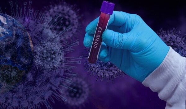 Koronavirus: U protekla 24 sata u Hrvatskoj 1.131 novi slučaj, u bolnicama 505 osoba