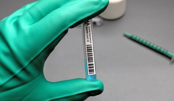 Hrvatska: 4.520 novih slučajeva u protekla 24 sata, u bolnicama ukupno 2.703 osobe