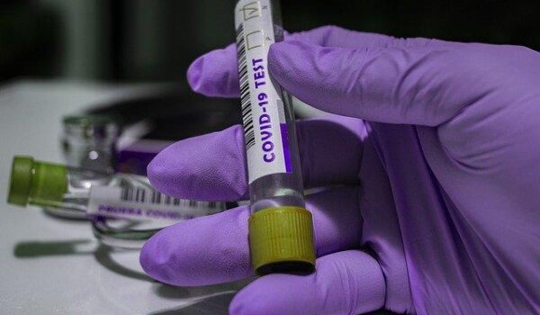 U Istri za vikend osam novozaraženih, 3051 cijepljenih