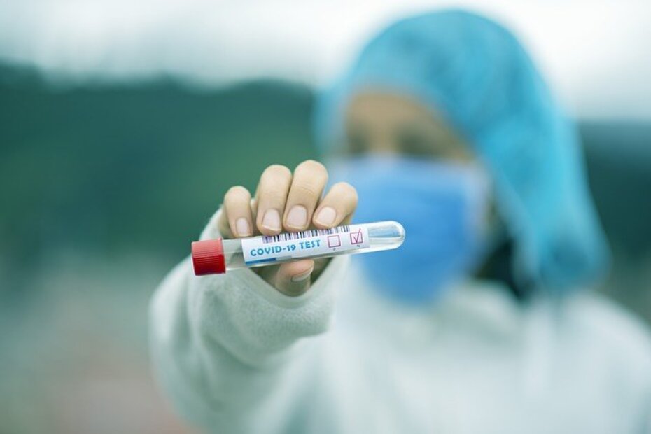 XU8 N9 XU7n test tube g94c4eb549 640