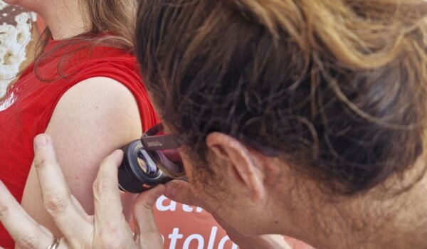 Porečani mogu pregledati kožu bez najave u subotu na Gradskom kupalištu