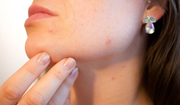 Novi termini za dermatološki pregled madeža – prednost Novigrađanima starije populacije